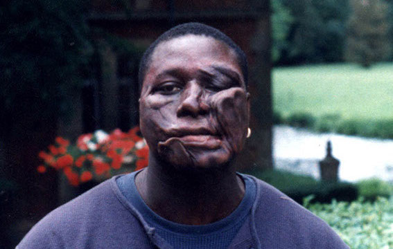 Protheses,cicatrices,blessures,brulures, faux sang,vieillisement,multi pieces,creatures,fantastique,film,theatre,publicite,silicon,latex